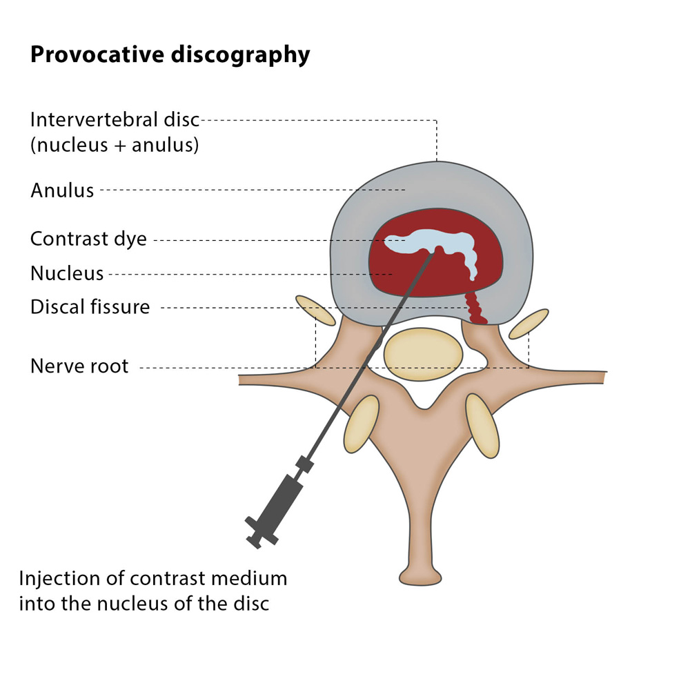 CIRSE Innovation Education Intervention